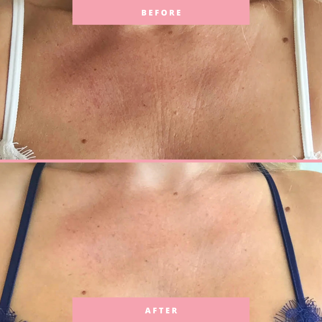 The Overnight Facelift Bundle