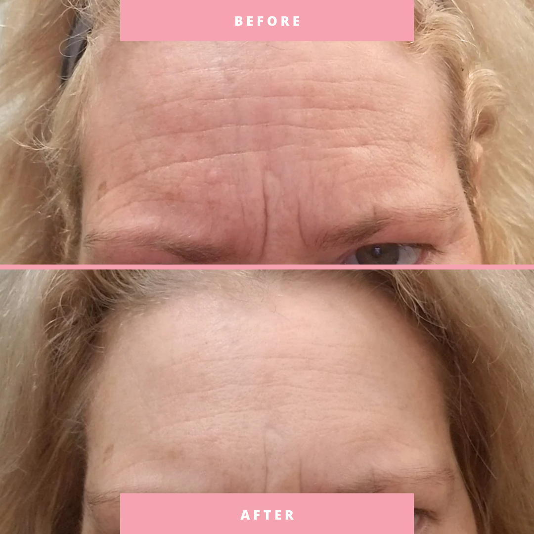 The Overnight Facelift Bundle