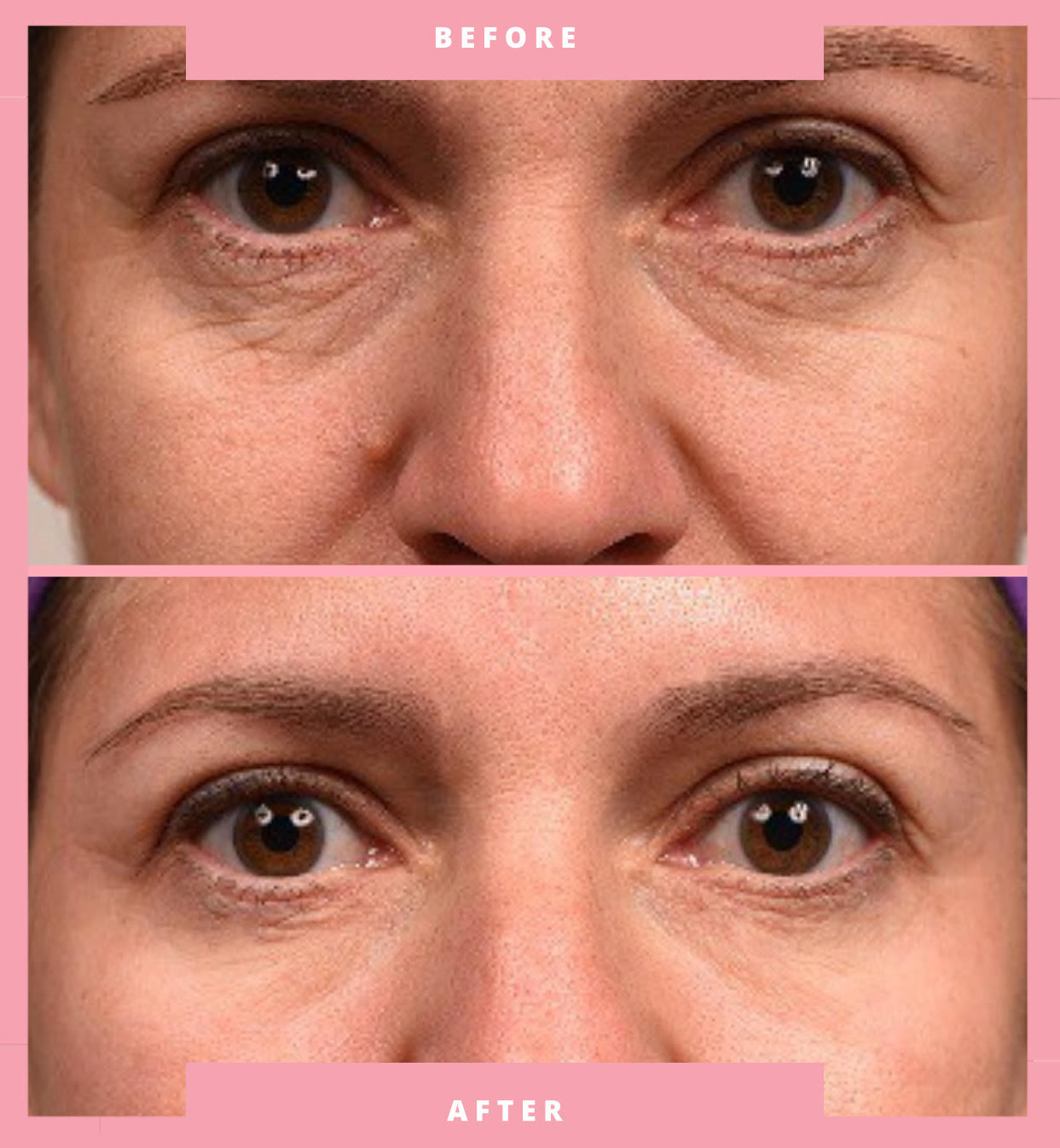 The Overnight Facelift Bundle