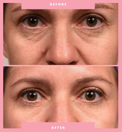 Lunelle Overnight Under-Eye patches - Set of 6 Patches